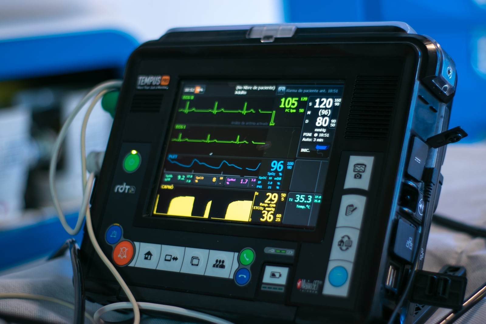 Portable Tempus Pro telemedicine monitor displaying ECG traces, blood pressure, oxygen saturation and respiratory data